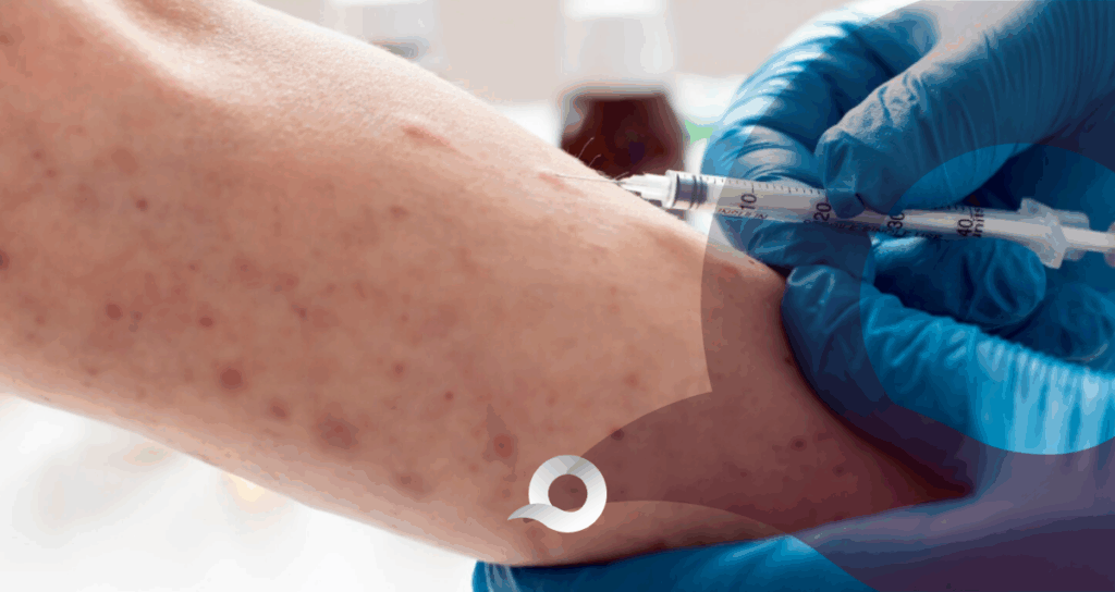 Sarampión en Hidalgo